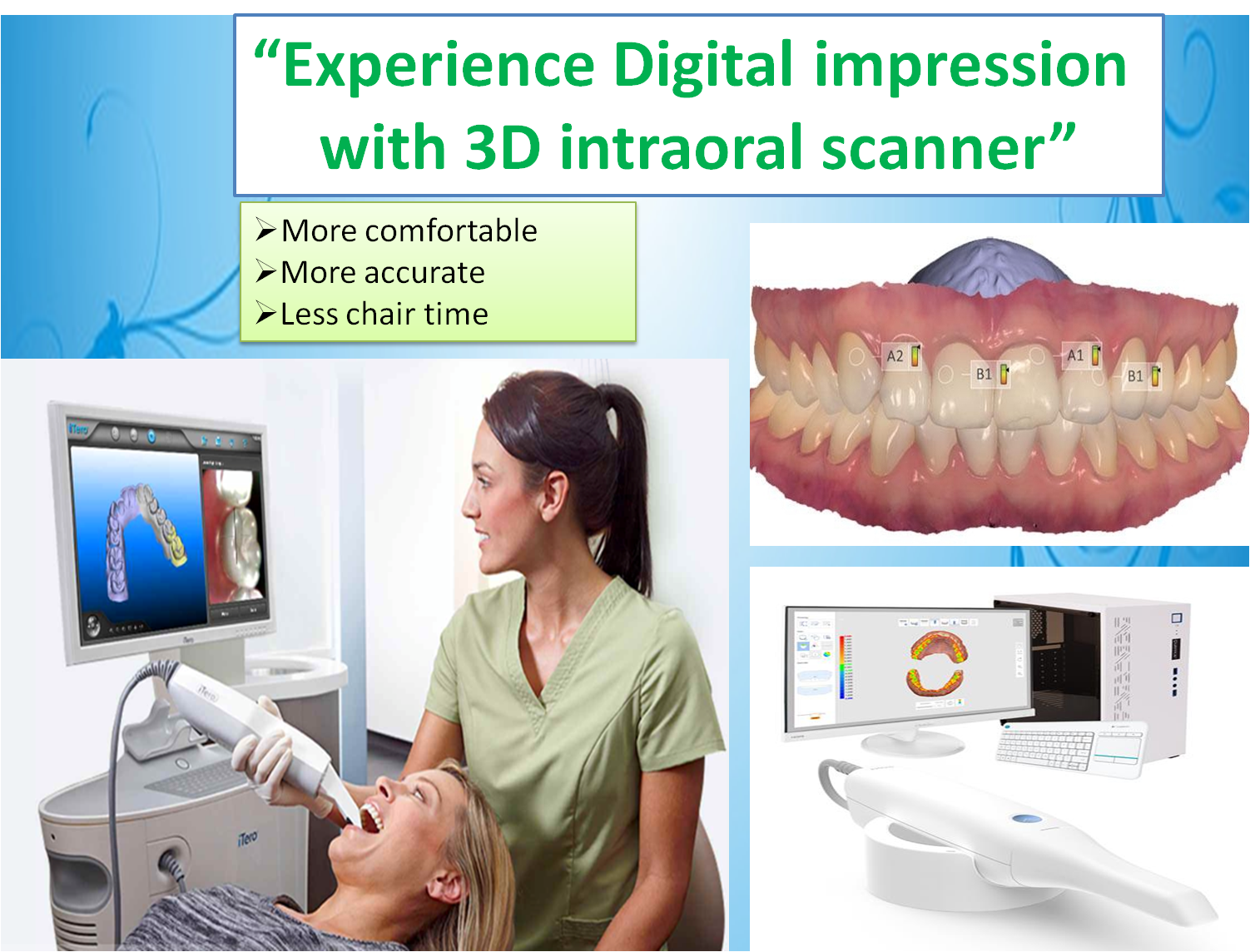 digital dental impression in chennai
