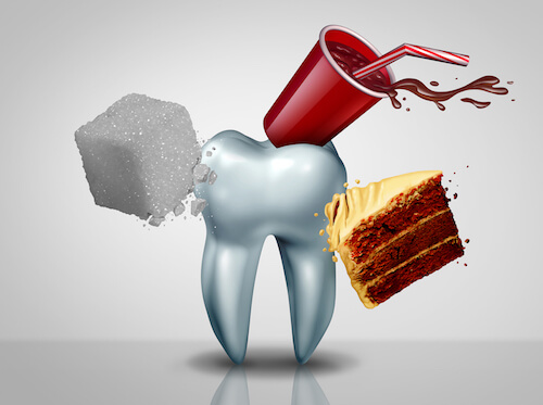 tooth decay causes