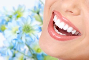 Best teeth braces cost in Chennai