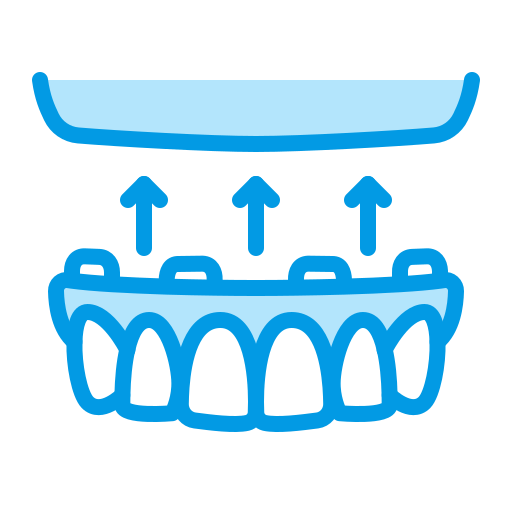 Front teeth implants