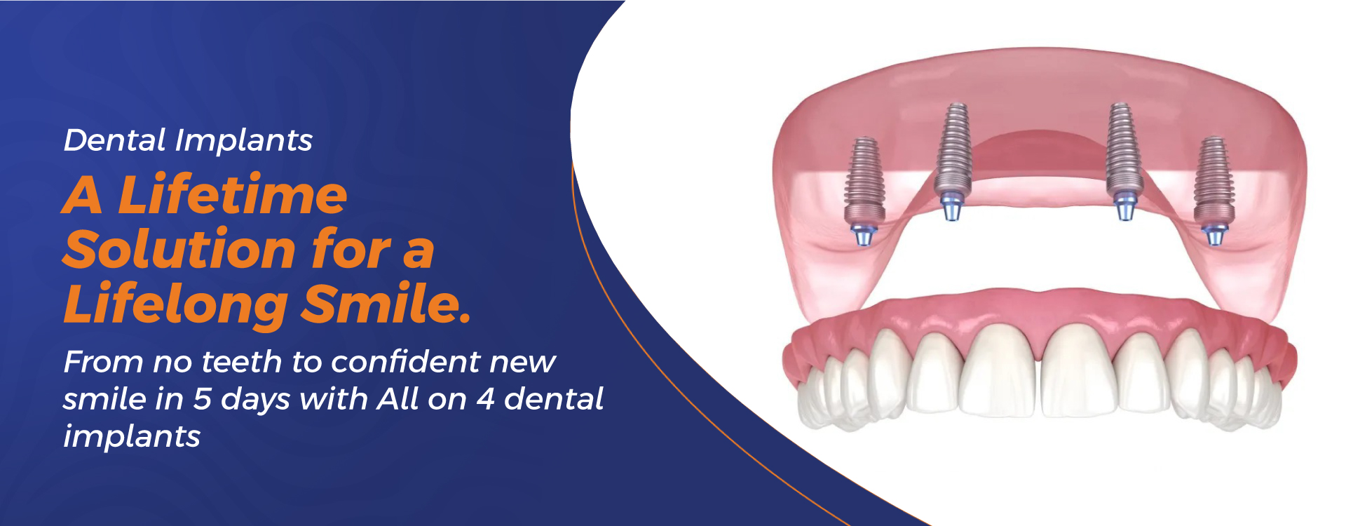 Best-Laser-Web-Banners-3