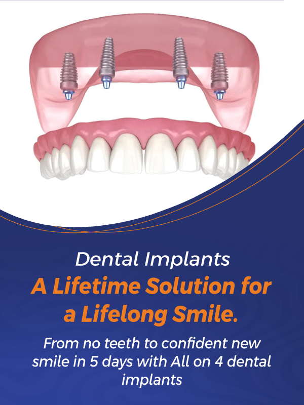 Best-Lasre-Mob-Banners-3 (1)